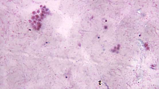 Caldivirga maquilingensis Chromatin protein Cren7 (creN7) -Mammalian Cell