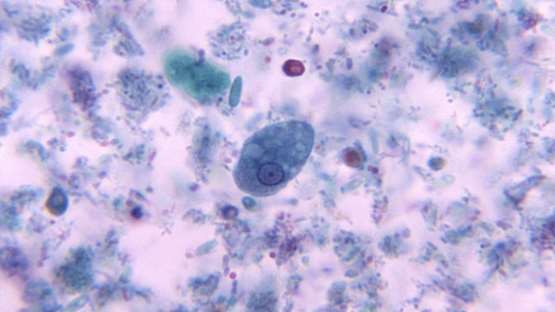 Ignicoccus hospitalis Chromatin protein Cren7 (creN7) -Mammalian Cell