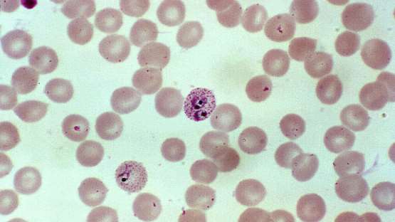 Cryptococcus neoformans var. neoformans serotype D Chromatin modification-related protein EAF3 (EAF3) -Baculovirus