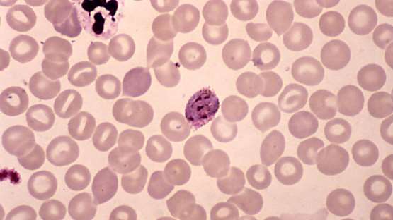 Saccharomyces cerevisiae Chromatin assembly factor 1 subunit p50 (MSI1) -Mammalian Cell